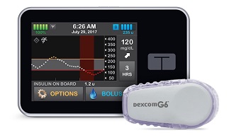 The Control-IQ artificial pancreas system. Source: Tandem Diabetes Care