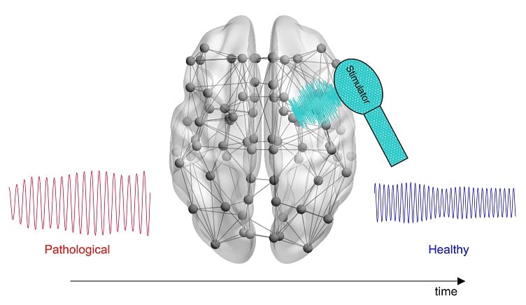 Computational Modeling for Treating Alzheimer's Disease