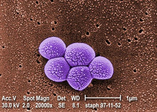 Figure 2: The deadly methicillin-resistant staphylococcus aureus (MRSA) bacteria. Source: CDC