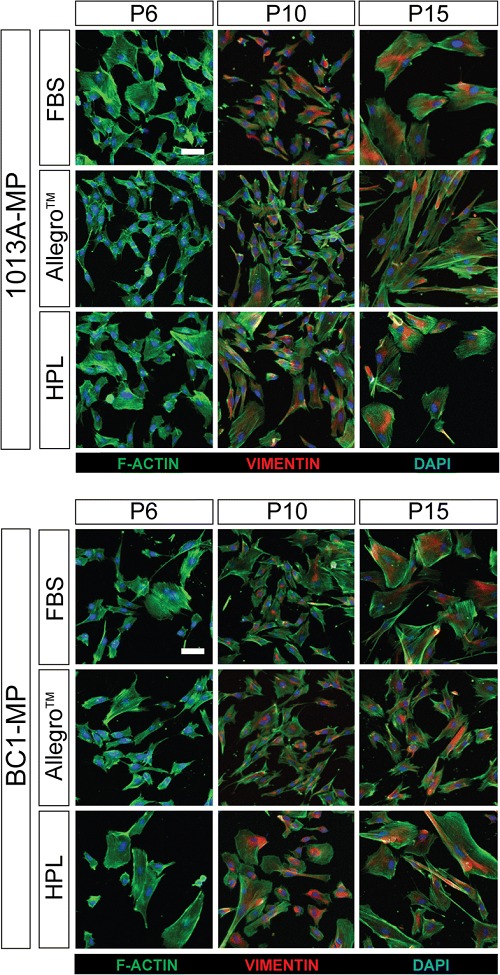 Cell painting showing the production of the cytoskeletal proteins F-actin and vimentin in induced pluripotent stem cell-derived mesodermal progenitors (line 1013A and BC1) cultured in different media. Source: New York Stem Cell Foundation Research Institute