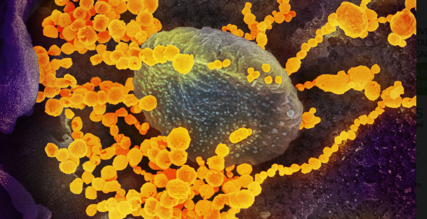 This scanning electron microscope image shows SARS-CoV-2 (round gold objects) emerging from the surface of cells cultured in the lab. Source: NIAID-RML