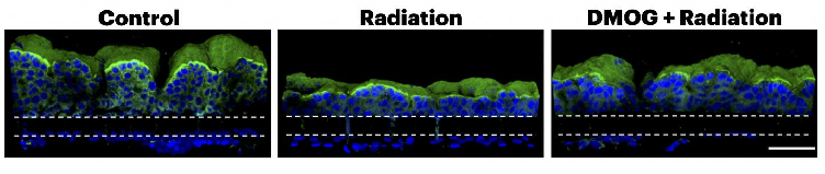 Study on 'Gut Chip' Points Toward Anti-radiation Drugs